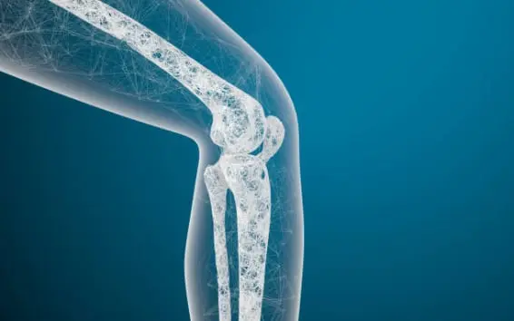 osteoporosis-knee-566x354.webp